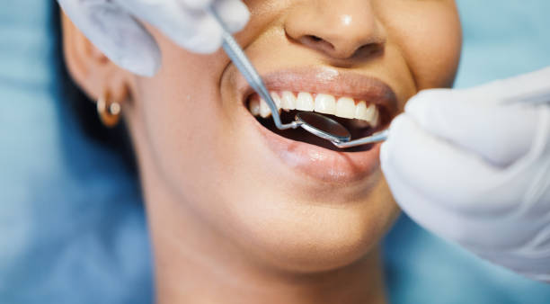 Best Emergency Wisdom Tooth Extraction in North Sea, NY